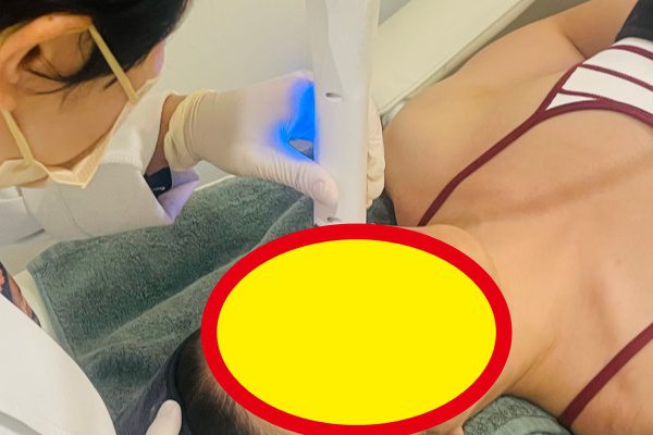 黄金微针搭配什么效果最好？水光、肉毒、热玛吉怎么选
