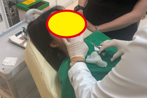 韩国美神针医生哪个好？效果自然不馒化，选对医生是关键