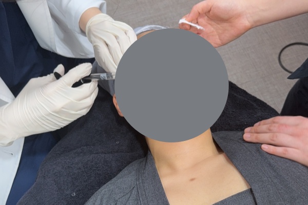 水光针多久打一次才有效?从打一次到养三年,韩国皮肤科告诉你水光针的正确打开方式