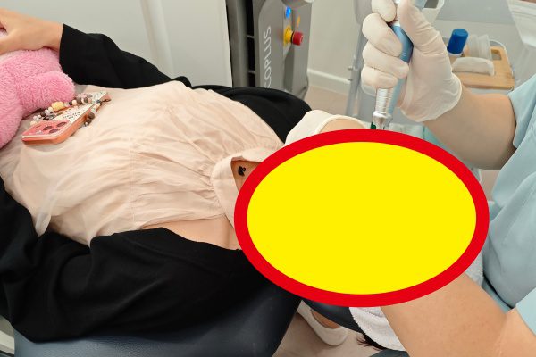眼部热玛吉去眼袋真的有效吗?价格多少、效果怎么样、能维持多久——一次讲清楚 1 眼部热玛吉去眼袋真的有效吗?价格多少、效果怎么样、能维持多久——一次讲清楚